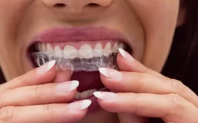 Invisalign Tarzana: Clear Aligner Therapy for Discreet Orthodontic Correction